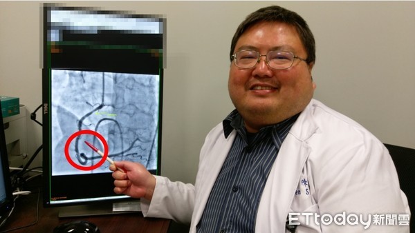 ▲▼圖說1-2：長安醫院心臟血管科陳士仁醫師表示，陳先生經檢查是下壁急性心肌梗塞圖說2：陳先生爬山時發生急性心肌梗塞，幸好緊急送醫接受心導管治療。copy OK圖說1-1：長安醫院心臟血管科陳士仁醫師表示，陳先生經檢查是下壁急性心肌梗塞，緊急。（圖／長安醫院提供）