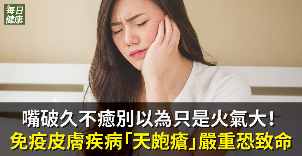 嘴破久不癒別以為只是火氣大 免疫皮膚疾病「天皰瘡」嚴重恐致命 | ETtoday探索 | ETtoday新聞雲