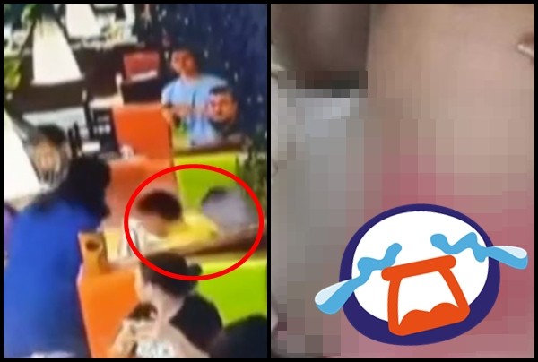 ▲▼店員失手灑下熱湯…男童大腿燒傷痛翻狂跳。（圖／翻攝自看看新聞）