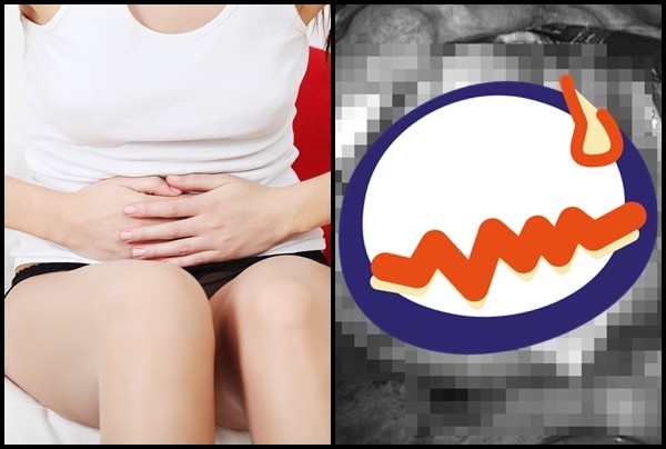 ▲▼21歲女腹部劇痛…醫竟挖出「畸胎瘤」。（圖／CFP）