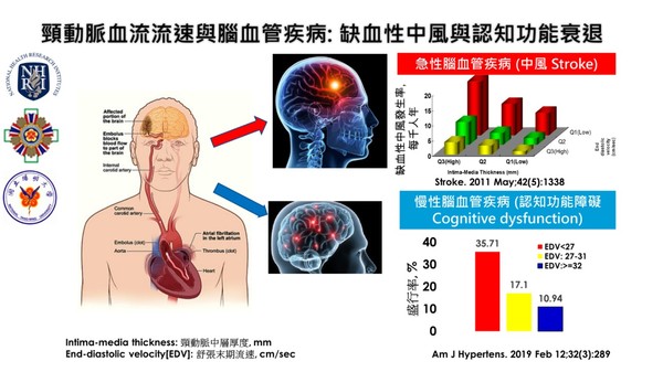 ▲▼▲▼國家衛生研究院頸動脈血流與認知功能研究。（圖／記者國衛院提供）