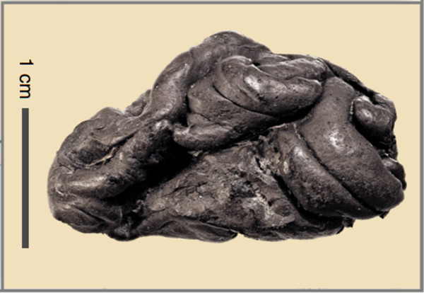 ▲丹麥考古團隊在石器時代「口香糖」上抽取DNA，重現5700年前小女孩蘿拉（Lola）的真面目。（圖／翻攝Nature Communications）