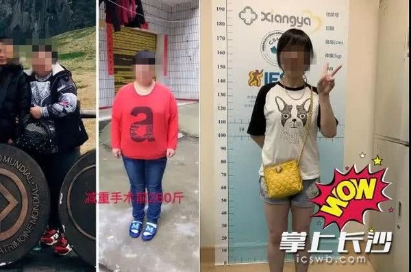 ▲▼130kg妹2年「減到剩40kg」　瘦到「指紋變形」辦身分證被拒。（圖／翻攝掌上長沙）