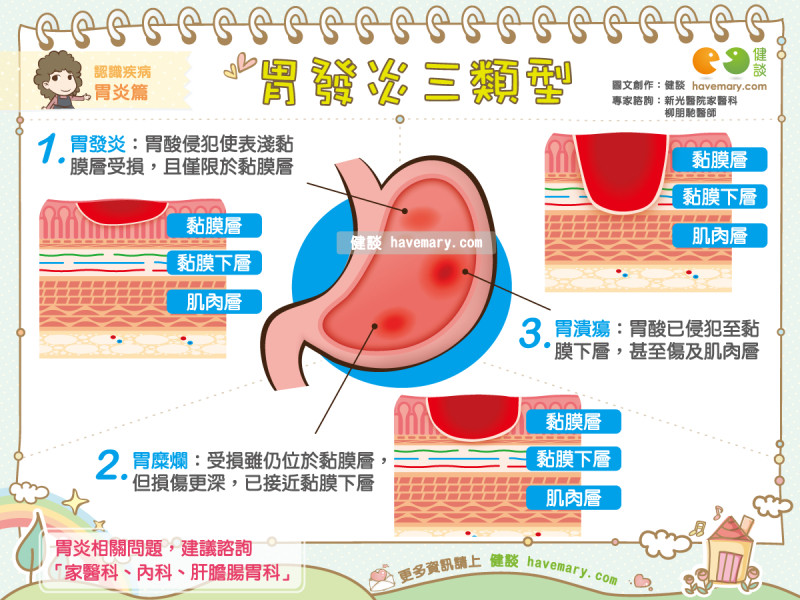 胃痛爆！醫曝發炎「分這3類型」…拖太久變胃癌。（圖／健談授權提供）