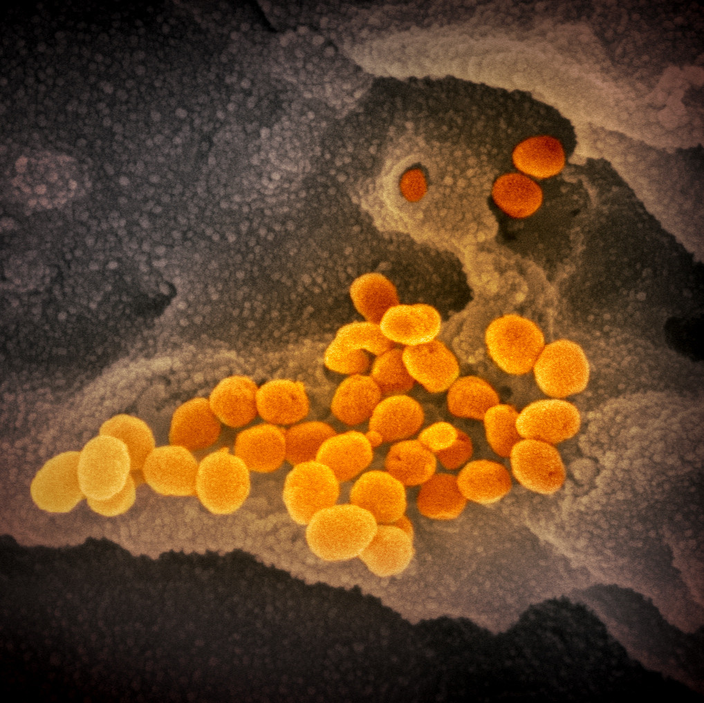 ▲▼新冠病毒顯微鏡彩照首度公佈。（圖／NIAID Flickr）