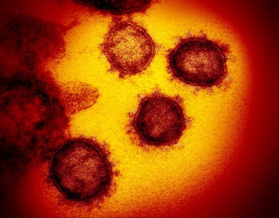 ▲▼ 新冠病毒顯微鏡彩照首度公佈 。（圖／NIAID Flickr）