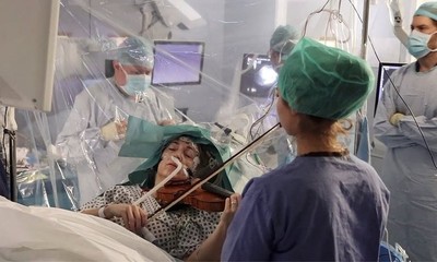 美女演奏家開顱摘腦瘤　途中「在手術台上拉小提琴」！醫：下刀更精準