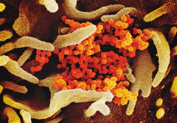 美國國家過敏和傳染病研究所公布新一批照片，可見新型冠狀病毒的顆粒（橘色）從實驗室中培養的細胞表面出現。（翻攝自美國國家過敏與傳染病研究院）