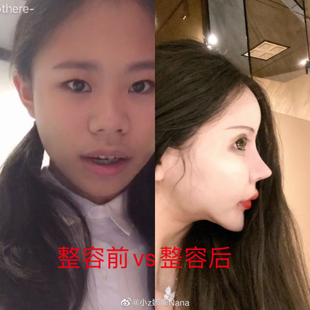 ▲整形前小娜也是是一個大眼睛的可愛的小妹妹，但整形後下巴削尖、眼晴比平常人大了將近一倍、鼻子尖得不像正常人類。（圖／翻攝大陸網站)