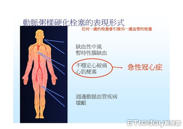 ▲台南市新市消防分隊救護員郭智雄等人，以12導程心電圖查出患者是急性心肌梗塞，馬上火速後送台南市立安南醫院做緊急心導管手術，成功挽救一命。（圖／記者林悅翻攝，下同）