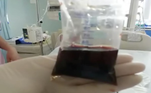 ▲▼3歲寶寶發燒還尿出醬油色，父母怕就醫被隔離私自給孩子用藥。（圖／翻攝自看看新聞）