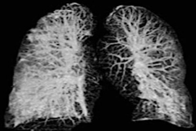 ▲▼ 肺部影像。（圖／翻攝arynews.tv）