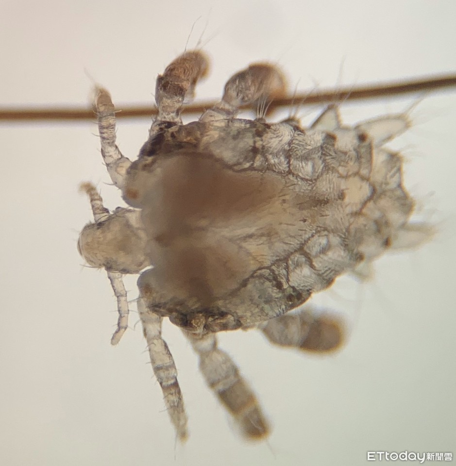 下體爆癢！驚見「6腳噁蟲」吸血鑽動醫揭治療4招：30%會出現其他性病| ETtoday健康雲| ETtoday新聞雲