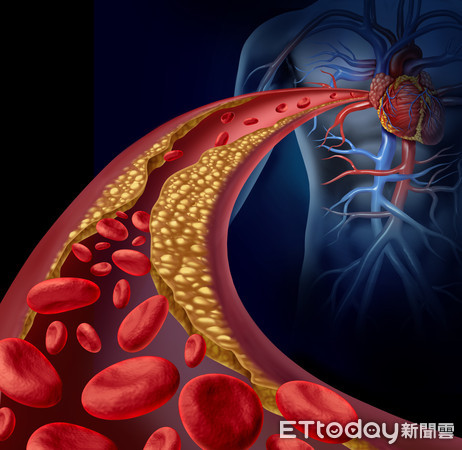 ▲▼血管。（示意圖／123RF）