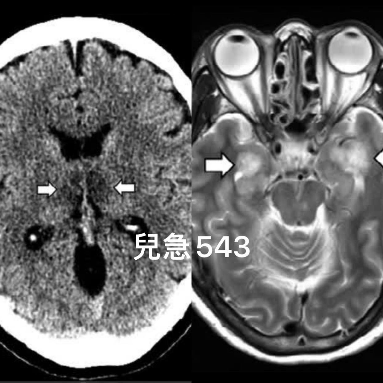 她染疫出現「超可怕病症」…4天後說不出話！醫嘆：非死即重傷。（圖／吳昌騰醫師授權提供）