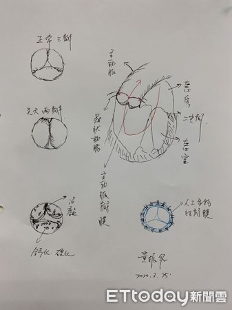 ▲▼手術過程順利且恢復狀況良好， 91歲徐爺爺緊握著醫師的手表達感謝。（圖／門諾醫院提供，下同）