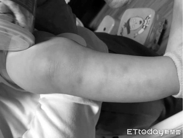▲台南市永康區1名男嬰，日前遭托嬰中心托育員不當照顧，造成男嬰頭部鈍傷、腿部瘀挫傷，現在還有其他受害孩童家長爆料，該托育員先前就有不當照顧紀錄。（圖／記者林悅翻攝，下同）