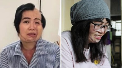 「媽媽，妳要一直愛我」賢妻遭夫潑酸毀容　自殺前，女兒一句話救回她