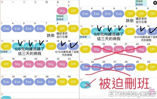 ▲獨／急診護師骨裂剛復原…想穿固定鞋！卻被砍半月班　督導：有礙觀瞻，會損醫院形象。（圖／熊女提供）