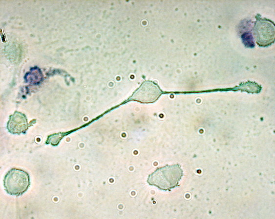 ▲一個位於老鼠體內的巨噬細胞，正在延伸其假足以吞沒兩粒可能是病原體的顆粒。（圖／翻攝維基百科）