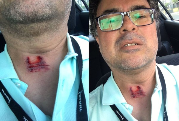 ▲▼記者採訪期間喉嚨遭「橡膠子彈直射」。（圖／翻攝自推特／Adolfo Guzman-Lopez）