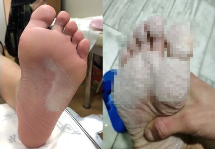 影 臭到爆 17歲弟腳底佈 鹹魚蒸蛋 媽狂轟 整棟樓都聞得到一脫鞋醫驚呆 Ettoday健康雲 Ettoday新聞雲