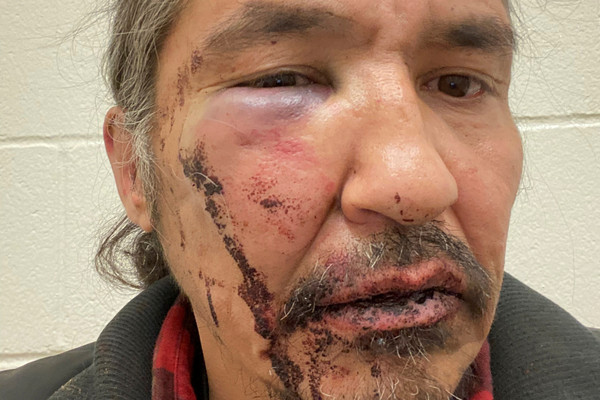 ▲加拿大原住民酋長拒捕遭警毆打。（圖／路透）