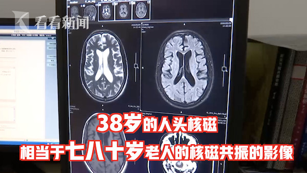 ▲▼ 38歲男子被查出“癡呆晚期” 。（圖／翻攝自看看新聞）