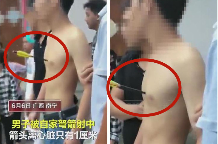 ▲▼年輕男被弓箭穿心。（圖／翻攝自微博）