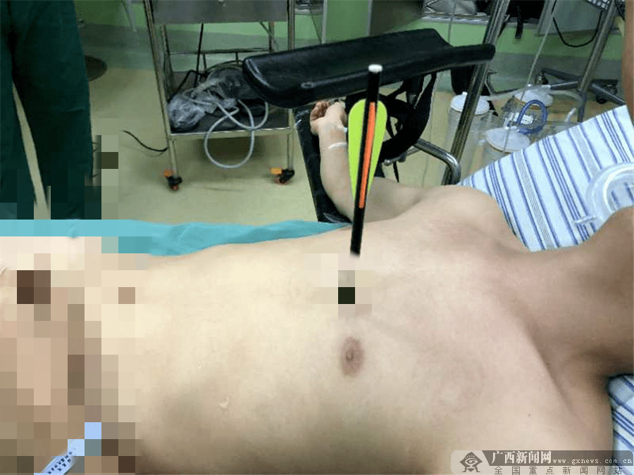 ▲▼年輕男被弓箭穿心。（圖／翻攝自微博）