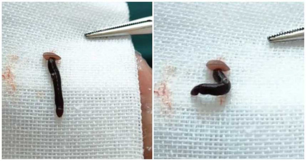 （合成圖／百度）