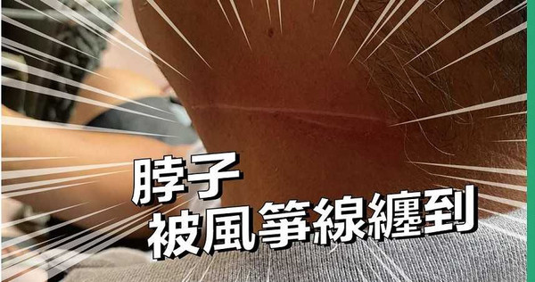 騎士今下午騎車行經龍岡路，卻被樹上的風箏線纏住脖子，留下怵目驚心的血痕。（圖／翻攝我是中壢人臉書）