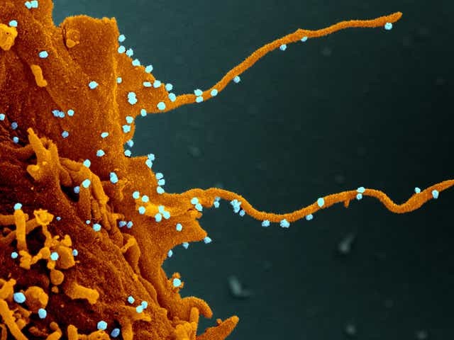 ▲▼美國加州大學舊金山分校研究團隊發現，病毒感染細胞後會透過其絲狀偽足去捕捉其他健康細胞。（圖／翻攝自推特「@LINFOCIT0」）