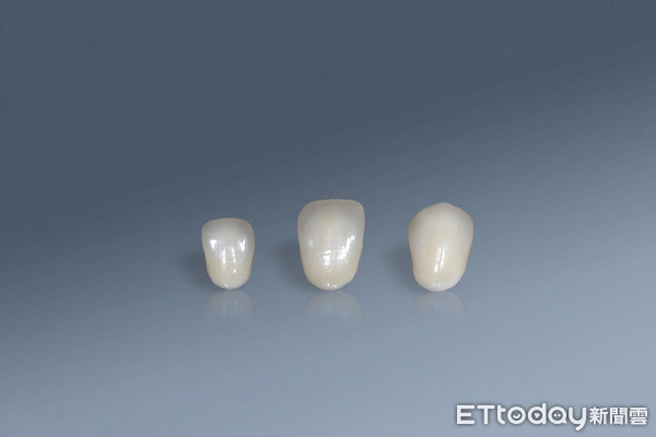 ▲高擬真3D列印法藍瓷氧化鋯成型牙冠前齒。（圖／法藍瓷提供）