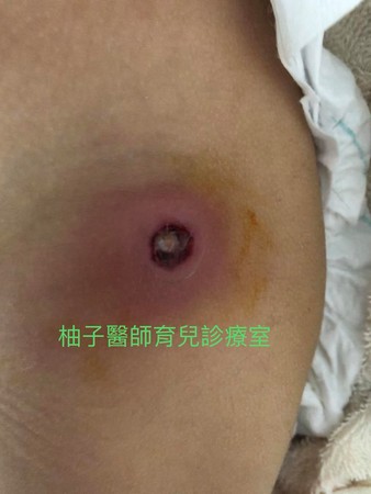 ▲▼綠膿桿菌。（圖／小兒科醫師陳木榮提供）