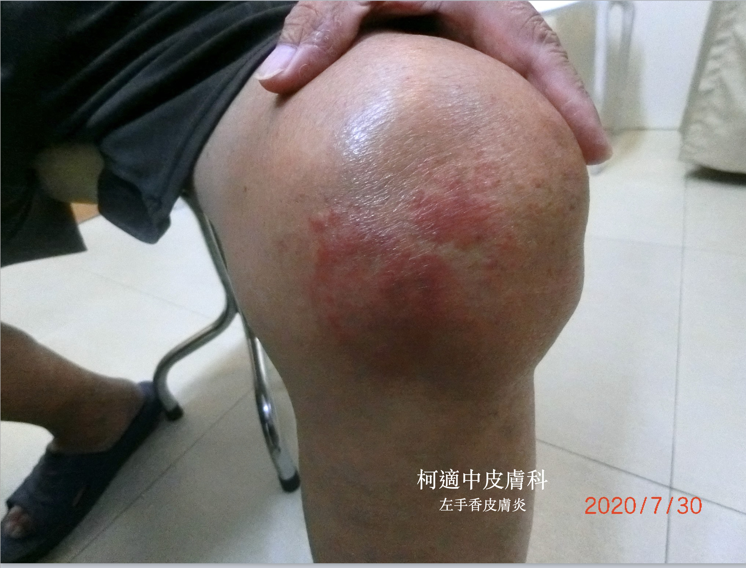 獨／痠痛狂敷香香涼涼「路邊草」！長輩說很有用醫急喊：千萬母湯喔| ETtoday健康雲| ETtoday新聞雲