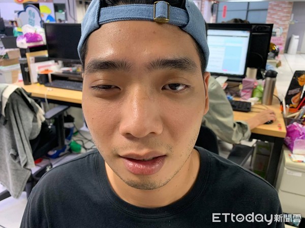 ▲▼中風,眼皮下垂。（圖／記者簡仲豪攝）