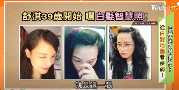 ▲▼白頭髮。（圖／截自節目健康2.0）