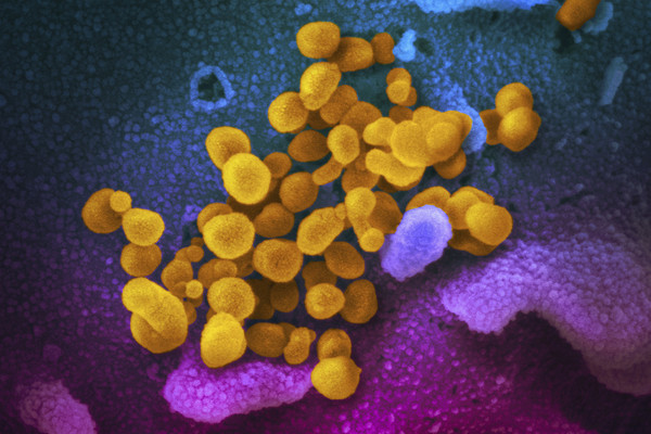 ▲美國國家過敏與傳染病研究所（NIAID）公布新冠病毒的顯微鏡照片。（圖／達志影像／美聯社）