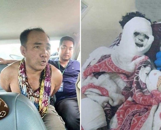▲柬埔寨43歲男庫布帕（左）不願分手，竟剁掉女友桑千達（右）的左手掌，並潑酸毀容。（圖／Cambodia National Police）