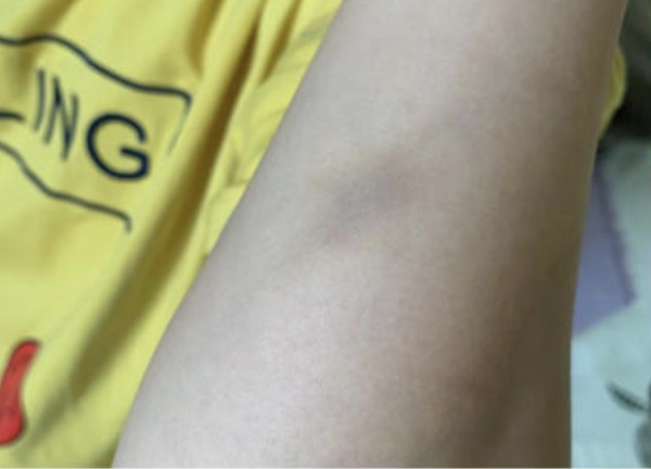 ▲▼朋友搶先自己買單　北京女客人用雨傘狂毆店員「打到無法上班」。（圖／翻攝紅星新聞）