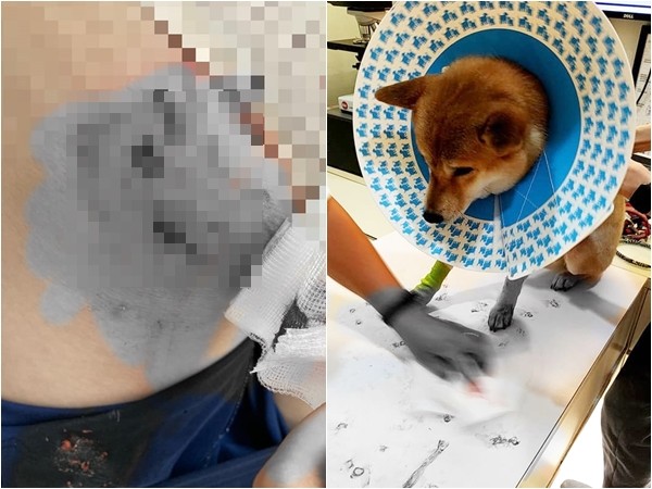 ▲▼黑狗發瘋狂咬！桃園女護犬「全身傷」停車場哀號　飼主緩慢靠近：別打我的狗。（圖／翻攝爆怨公社）