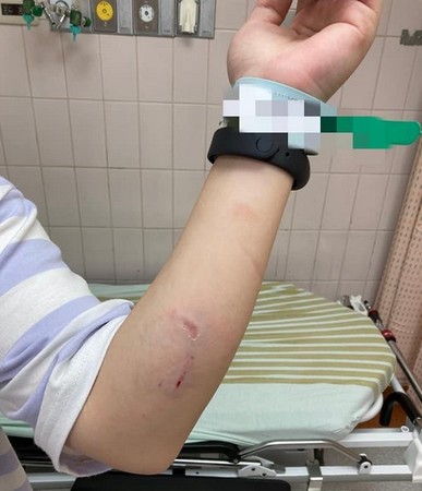 ▲遭兩隻大黑狗攻擊受傷的柴犬。（圖／翻攝自爆料公社）