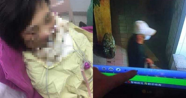 女網友4年前遭潑酸，凶手至今仍未遭逮。（圖／翻攝自爆廢公社）