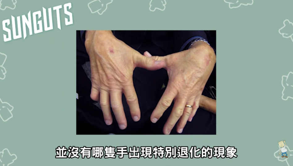 折手指會變粗、傷關節？美醫師「自虐60年」…驚人結果揭曉了。（圖／截自《三個字SunGuts》YouTube）
