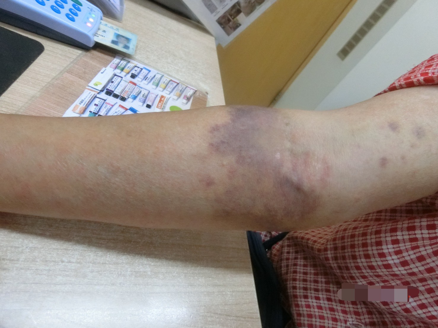 獨 拜拜遇仙姑驚喊 有蛇 狂揍她手要斬魔超慘真相曝光 Ettoday健康雲 Ettoday新聞雲