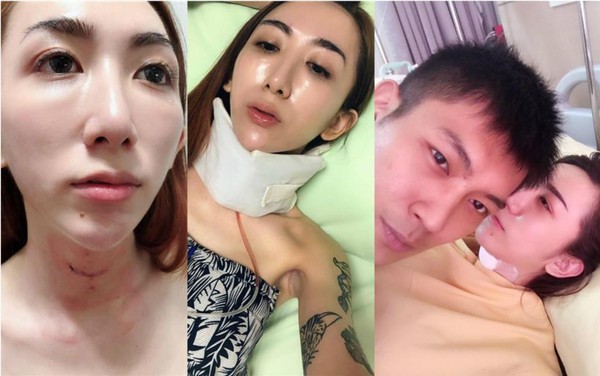 「罔腰」2017年遠赴泰國做變性手術，當時的男友「鳳梨」全程陪伴在旁，讓她有託付終生想嫁的意願。（翻攝自罔腰尬鳳梨臉書）