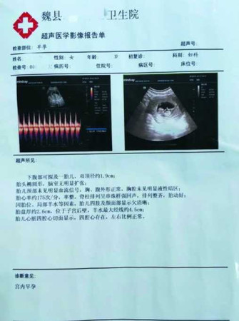 小雨已懷孕50天。