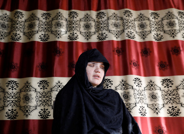 ▲▼ 阿富汗33歲女子庫泰菈（Khatera）外出工作，卻因父親反對，慘被武裝份子戳瞎雙眼。（圖／路透）