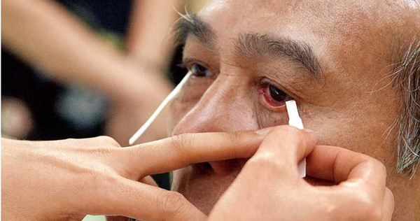 乾眼症的傳統檢查方式是進行淚液檢測，但此法較難發現缺油性乾眼症，因此乾眼症的罹患人數容易被低估。（圖／報系資料庫）